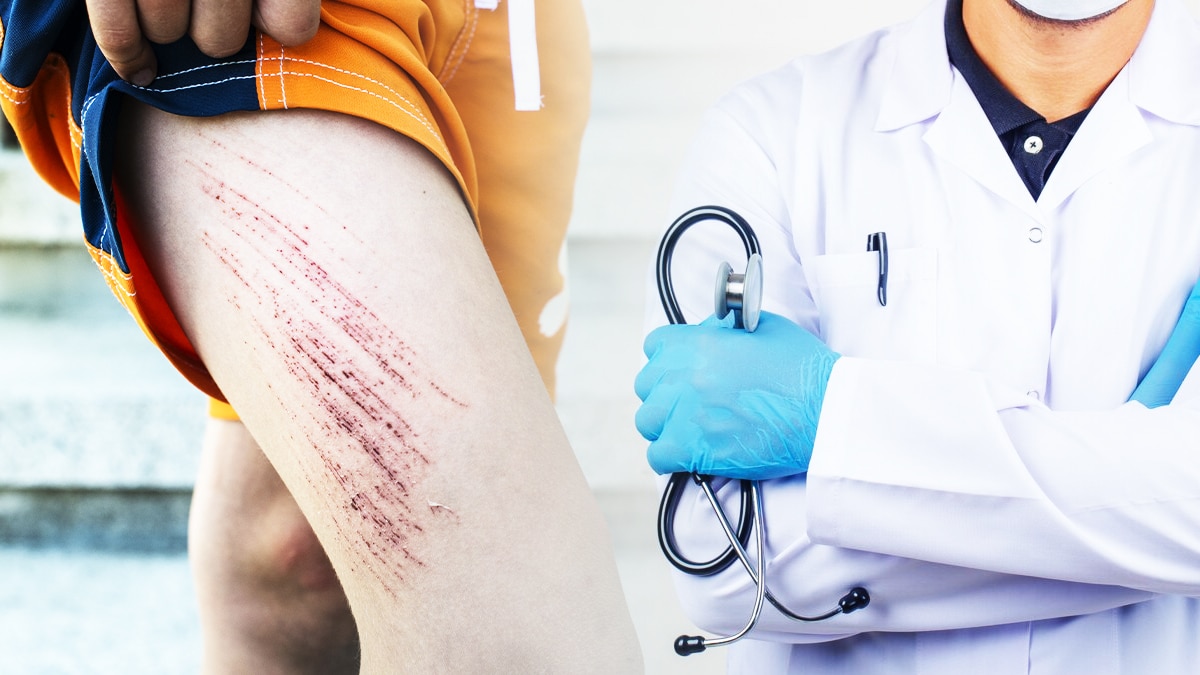 Ce que je croyais être une simple éraflure s’est transformé en urgence médicale : en 48 heures, ma jambe a failli coûter cher, et le médecin m’a averti que j’avais échappé de justesse à une septicémie mortelle.